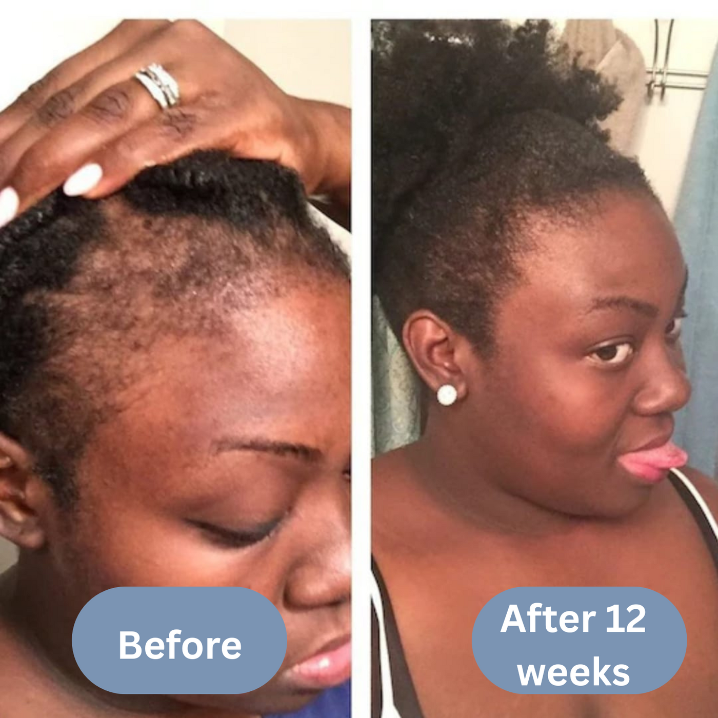 Scalpy Hair Revival Serum