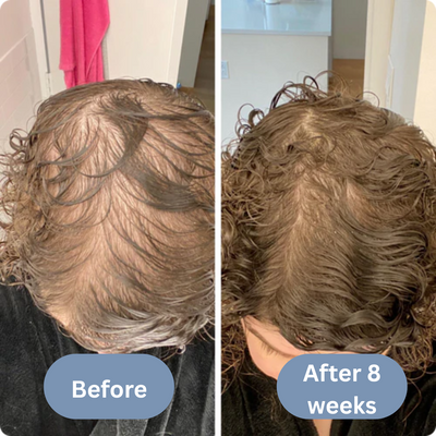 Scalpy Hair Revival Serum