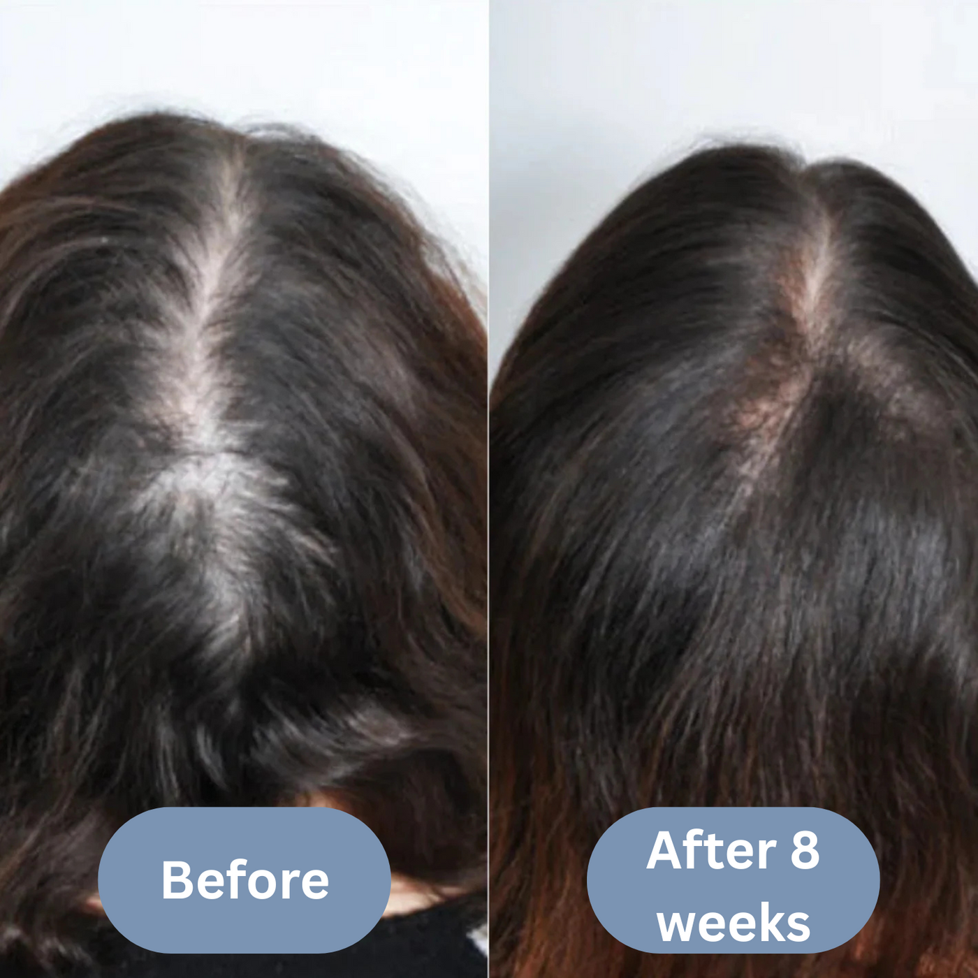 Scalpy Hair Revival Serum